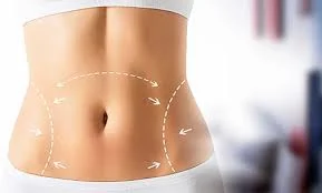 ۱۰ کلینیک برتر لاغری موضعی در صادقیه + راهنمای خرید
