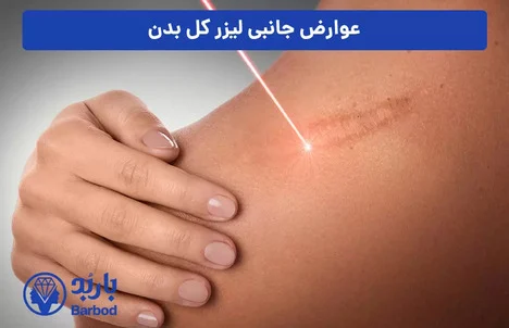خدمات لیزر فول بادی : راحتی، سرعت و اثربخشی