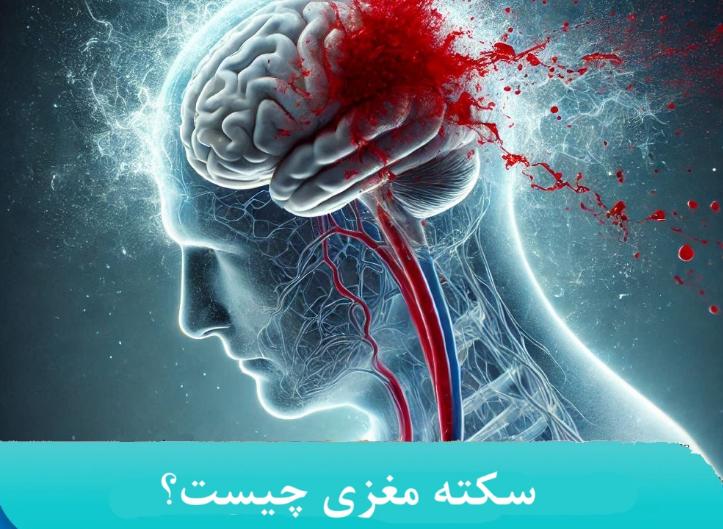 عوامل موثر در جلوگیری از بروز سکته مغزی در افراد بالای ۶۰ سال