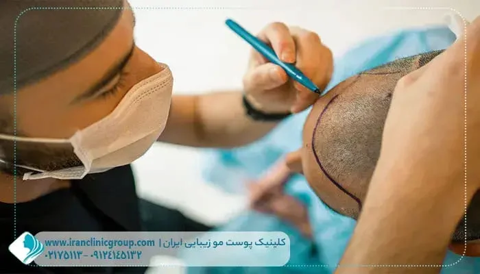 کاشت مو | کلینیک بهترین کلینیک های کاشت مو از نظر مردم