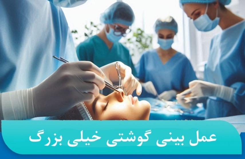 جراحی بینی گوشتی بزرگ با دکتر حمیدرضا مفرد : تجربه ای موفق از تغییرات طبیعی