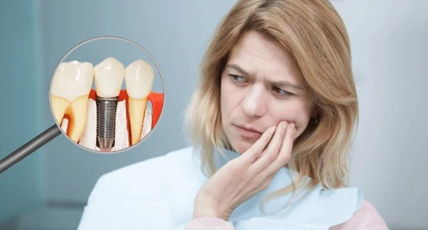 بعد از ایمپلنت چند روز درد داریم؟