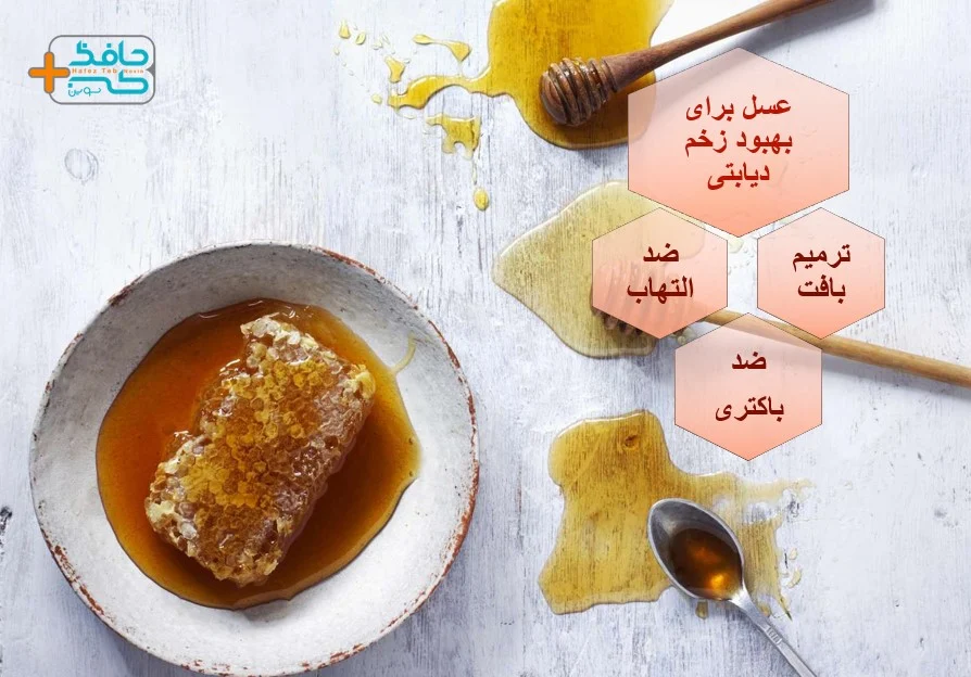 عسل برای درمان زخم دیابتی