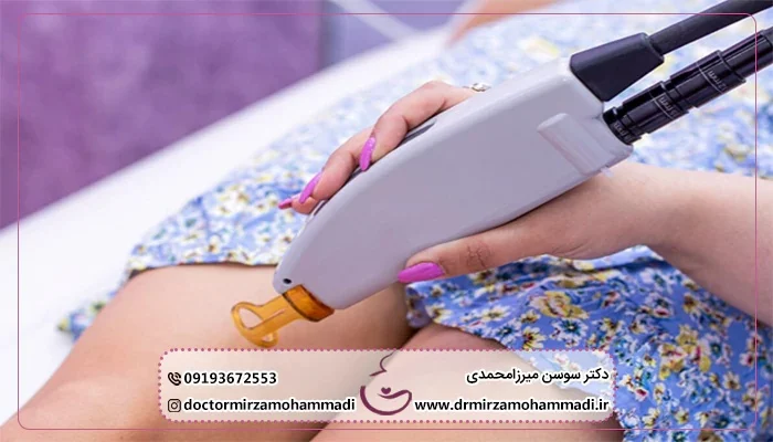 درمان | پوست تاثیر لیزر ژولیت واژینال در درمان خشکی و شل شدگی واژن