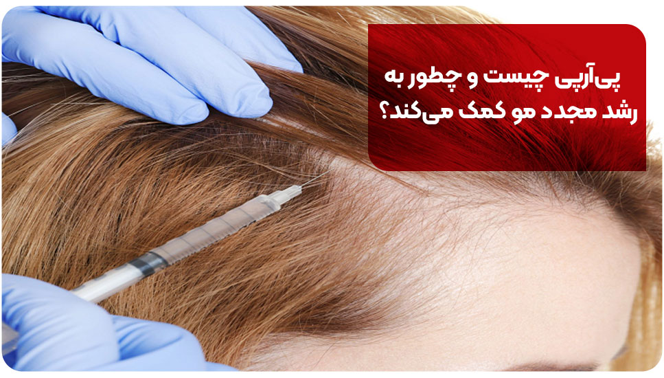 پی‌آر‌پی چیست و چطور به رشد مجدد مو کمک می‌کند؟