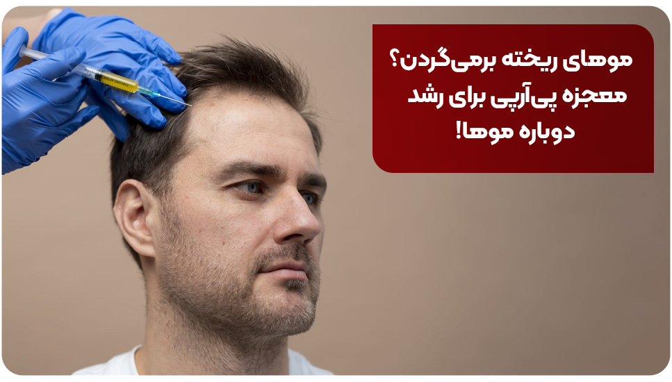 موهای ریخته برمی گردن؟ معجزه پی آر پی برای رشد دوباره موها