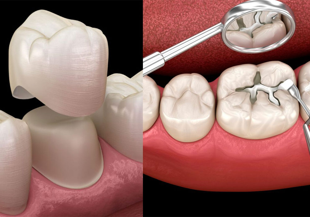 بهترین کلینیک دندان پزشکی برای عصب‌کشی و روکش دندان