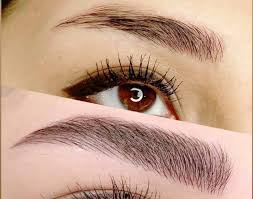 فیبروز ابرو چگونه انجام می‌شود؟